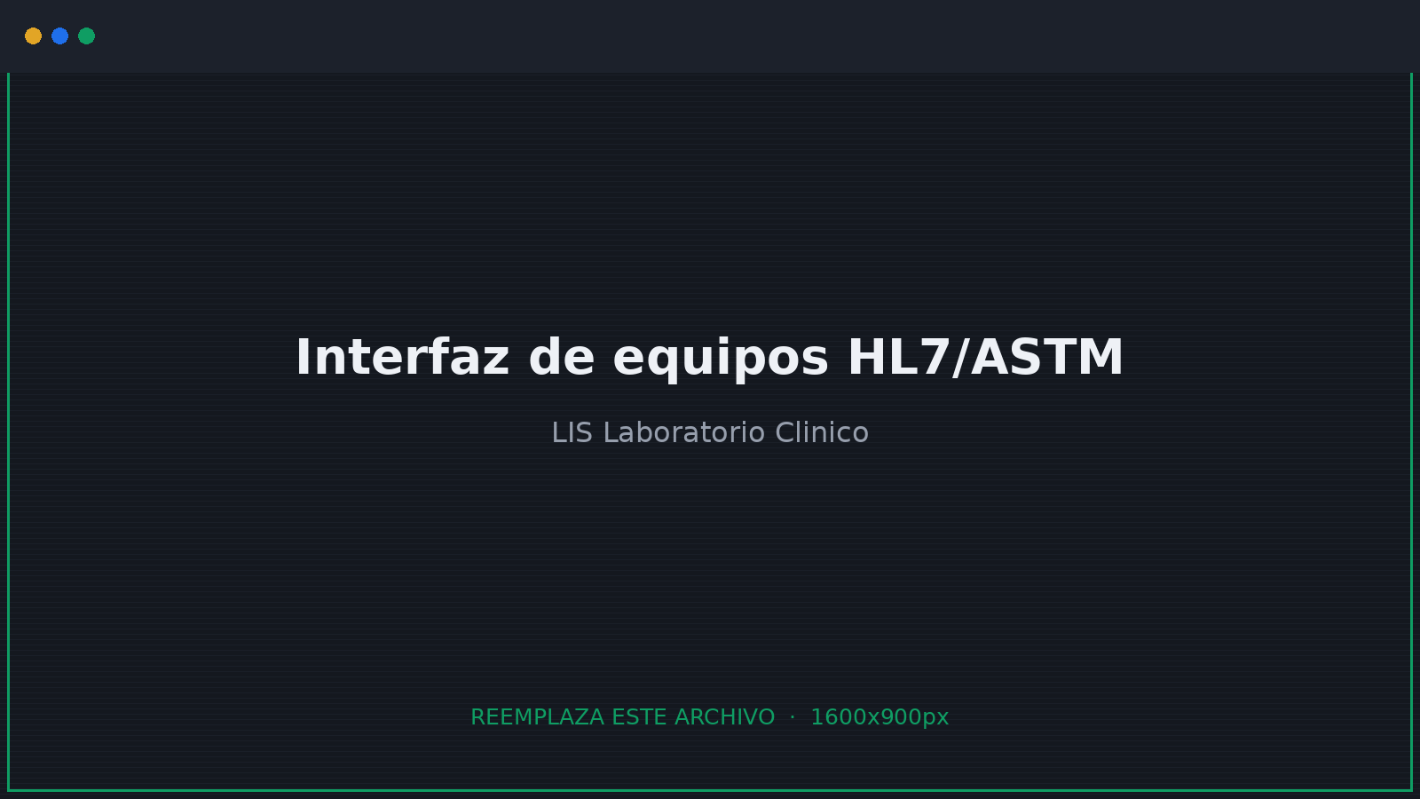 Interfaz de equipos